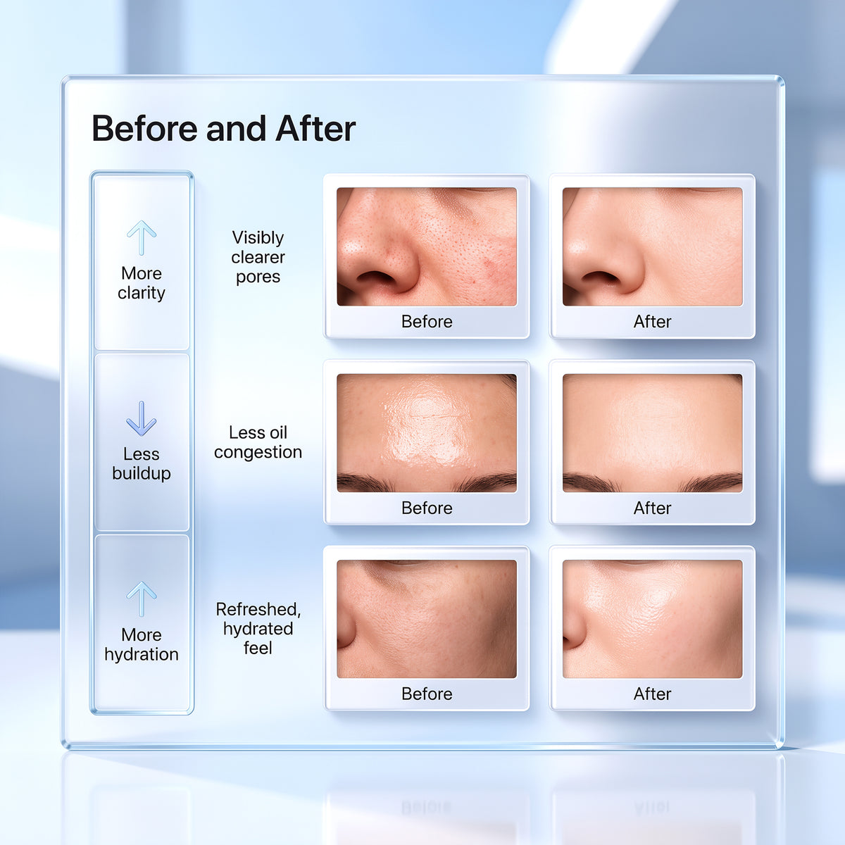 Beautyfish R5 Hydro Cleanse System | At-Home Deep Pore Cleanse Face Device